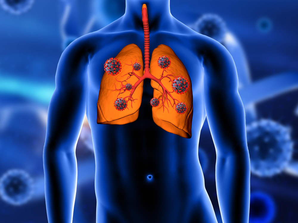 Pulmonary & Respiratory Care in Forbesganj | Asthma & Lung Health Treatment | Dr. Faizur Rahman
